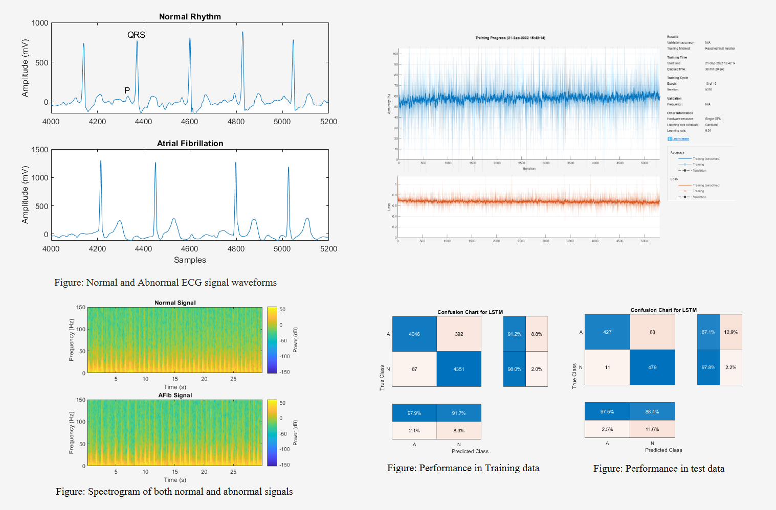 Heartbeat anomaly detection